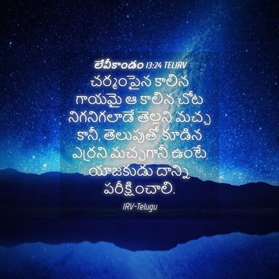 Picture 04 - లేవీకాండం 13:24 TELIRV - చర్మంపైన కాలిన - Bible Verse Picture