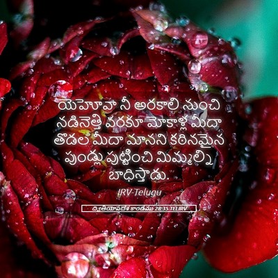 Picture 05 - ద్వితీయోపదేశ కాండము 28:35 TELIRV - యెహోవా నీ అరకాలి - Bible Verse Picture