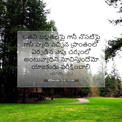 Picture 07 - లేవీకాండం 13:43 TELIRV - అతని బట్టతలపై - Bible Verse Picture